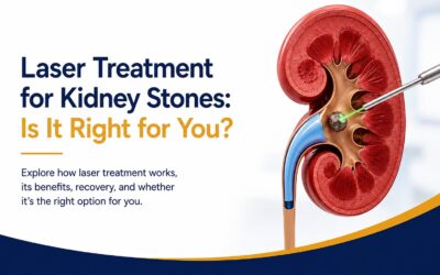 Laser Treatment for Kidney Stones: Is It Right for You?