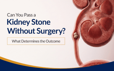 Can You Pass a Kidney Stone Without Surgery? What Determines the Outcome
