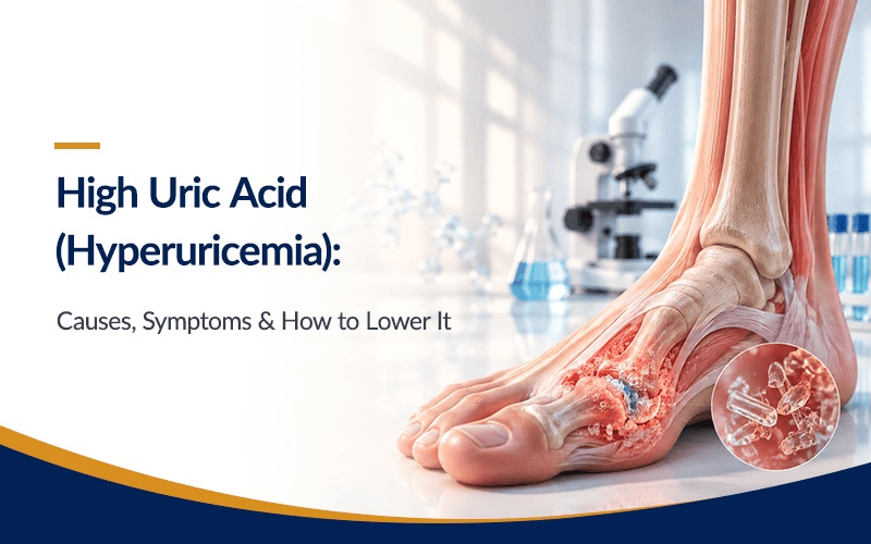 High Uric Acid (Hyperuricemia) Causes, Symptoms & How to Lower It